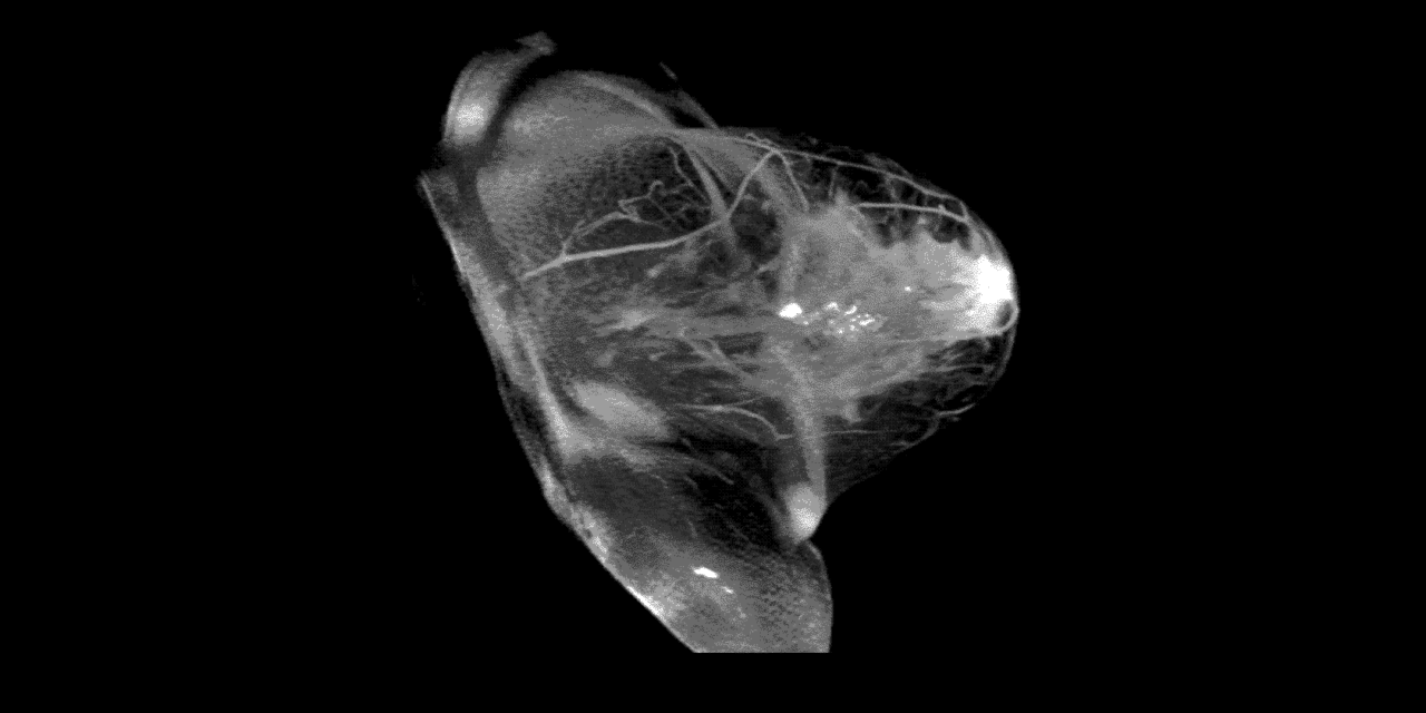 Breast Health Imaging